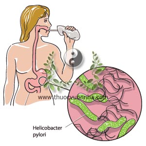 vi khuẩn Helicobacter pylori